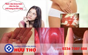 Bệnh viện khám bệnh viêm âm đạo chất lượng tại Đà Nẵng